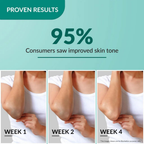 Fixderma Nigrifix Cream 100gm